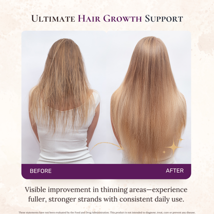 Phase II Upkeep Formula